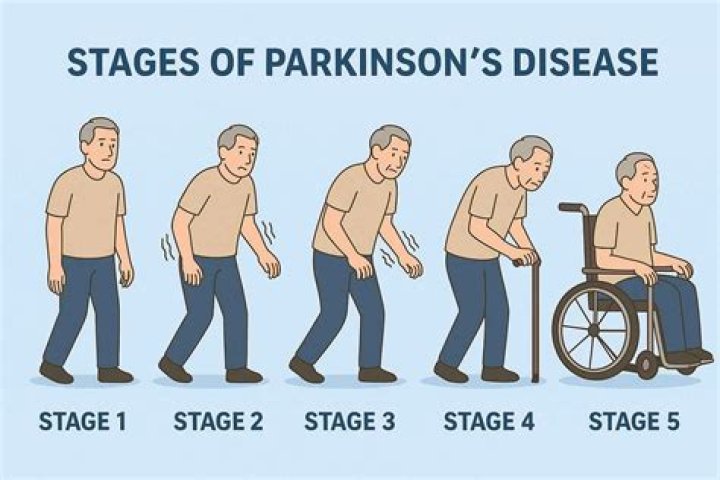 Does Mark Levin Have Parkinson's? Understanding His Health Status