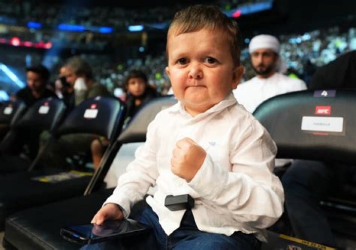 How Old is Hasbulla? The Rise of a Viral Sensation