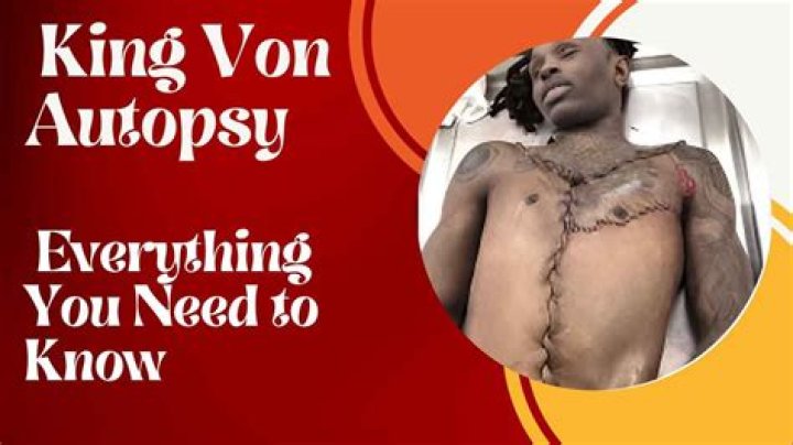 King Von Autopsy Photo: Understanding the Impact and Legacy