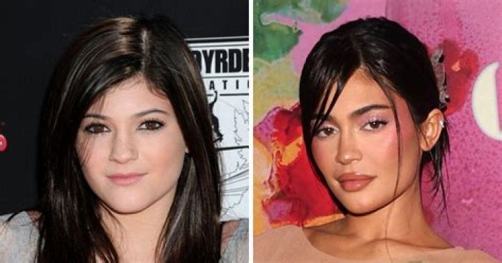 Kylie Jenner Before Plastic Surgery: A Closer Look at Her Transformation