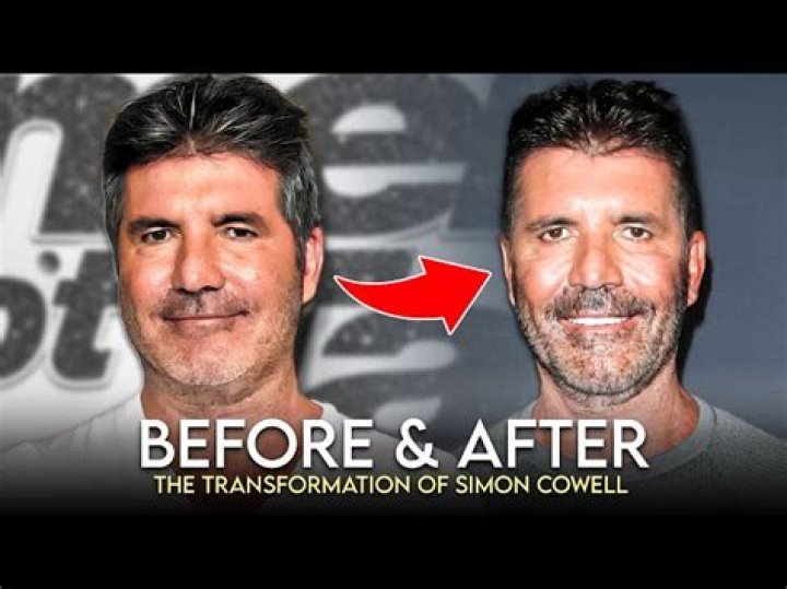 Simon Cowell Before and After: A Comprehensive Transformation Journey