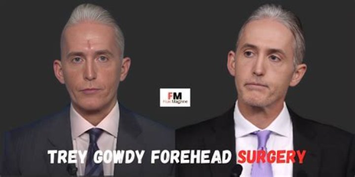 Trey Gowdy Forehead Surgery: Unveiling the Truth Behind His Transformation