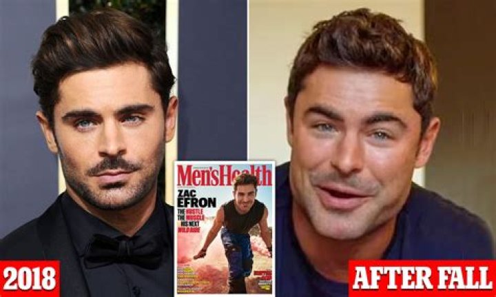 Zac Efron's Face Change: An In-Depth Look at His Transformation